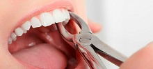Эстетика и удаление зуба